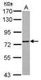 Zinc Finger Protein 418 antibody, LS-C155710, Lifespan Biosciences, Western Blot image 
