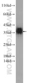Small glutamine-rich tetratricopeptide repeat-containing protein alpha antibody, 11019-2-AP, Proteintech Group, Western Blot image 