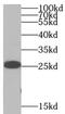 Synaptosome Associated Protein 25 antibody, FNab08056, FineTest, Western Blot image 