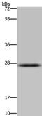 Hydroxysteroid 17-Beta Dehydrogenase 14 antibody, PA5-50425, Invitrogen Antibodies, Western Blot image 