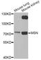 Moesin antibody, A12463, ABclonal Technology, Western Blot image 