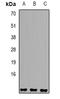 Small Nuclear Ribonucleoprotein Polypeptide E antibody, orb340927, Biorbyt, Western Blot image 