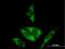 Ribosomal Protein L29 antibody, H00006159-B01P, Novus Biologicals, Immunocytochemistry image 