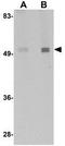 Immunity Related GTPase Cinema antibody, GTX85258, GeneTex, Western Blot image 