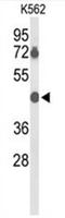 BTB/POZ domain-containing protein 10 antibody, AP50399PU-N, Origene, Western Blot image 