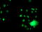 Glutathione S-Transferase Theta 2 (Gene/Pseudogene) antibody, M09339, Boster Biological Technology, Immunofluorescence image 