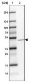 Mannosyl (Alpha-1,3-)-Glycoprotein Beta-1,2-N-Acetylglucosaminyltransferase antibody, NBP1-81827, Novus Biologicals, Western Blot image 