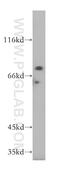 Large 60S Subunit Nuclear Export GTPase 1 antibody, 17750-1-AP, Proteintech Group, Western Blot image 
