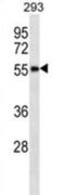 RNA Binding Motif Protein 48 antibody, abx026958, Abbexa, Western Blot image 