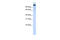 BTB Domain And CNC Homolog 2 antibody, 25-527, ProSci, Western Blot image 