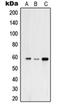Ubiquitin Specific Peptidase 30 antibody, orb215327, Biorbyt, Western Blot image 