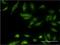 Choline Kinase Beta antibody, H00055500-M09, Novus Biologicals, Immunofluorescence image 