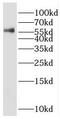 Pre-MRNA Processing Factor 4 antibody, FNab06817, FineTest, Western Blot image 