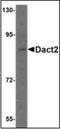 Dishevelled Binding Antagonist Of Beta Catenin 2 antibody, orb89212, Biorbyt, Western Blot image 