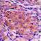 Fortilin antibody, LS-C352960, Lifespan Biosciences, Immunohistochemistry paraffin image 