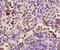 HAS1 antibody, GTX60186, GeneTex, Immunohistochemistry paraffin image 