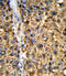 Glutathione S-transferase A2 antibody, abx034364, Abbexa, Immunohistochemistry paraffin image 