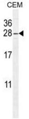 ADP-ribosylation factor-like protein 5B antibody, AP50247PU-N, Origene, Western Blot image 