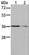 Aldo-Keto Reductase Family 1 Member B10 antibody, LS-C401207, Lifespan Biosciences, Western Blot image 