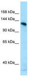 AMP deaminase 2 antibody, TA338196, Origene, Western Blot image 