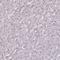 Dual Specificity Phosphatase 28 antibody, NBP1-94058, Novus Biologicals, Immunohistochemistry paraffin image 
