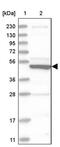 Solute Carrier Family 10 Member 3 antibody, PA5-54486, Invitrogen Antibodies, Western Blot image 