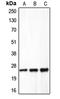 Claudin 5 antibody, LS-C352946, Lifespan Biosciences, Western Blot image 