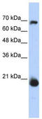 Coiled-Coil-Helix-Coiled-Coil-Helix Domain Containing 4 antibody, TA339991, Origene, Western Blot image 