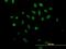 A-Kinase Anchoring Protein 17A antibody, H00008227-B01P, Novus Biologicals, Immunocytochemistry image 