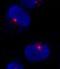 Centrosomal Protein 290 antibody, NB100-86991, Novus Biologicals, Immunocytochemistry image 