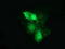 Catenin Beta 1 antibody, LS-C172584, Lifespan Biosciences, Immunofluorescence image 