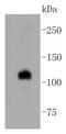 Notch1b antibody, NBP2-67420, Novus Biologicals, Western Blot image 