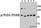 Phospholipase D2 antibody, A02586Y169, Boster Biological Technology, Western Blot image 
