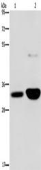 Microtubule-associated protein RP/EB family member 3 antibody, TA349912, Origene, Western Blot image 