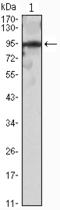Zinc finger protein SNAI2 antibody, M01615, Boster Biological Technology, Western Blot image 