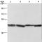 Alcohol Dehydrogenase 1A (Class I), Alpha Polypeptide antibody, LS-C404480, Lifespan Biosciences, Western Blot image 