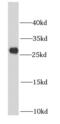 NADH:Ubiquinone Oxidoreductase Core Subunit V2 antibody, FNab05636, FineTest, Western Blot image 