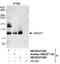 Ankyrin repeat and zinc finger domain-containing protein 1 antibody, NB100-61589, Novus Biologicals, Western Blot image 