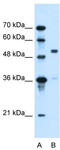 Solute Carrier Family 37 Member 3 antibody, TA333311, Origene, Western Blot image 