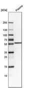 Fukutin Related Protein antibody, PA5-63857, Invitrogen Antibodies, Western Blot image 