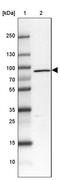 Leucine Zipper Tumor Suppressor 2 antibody, PA5-60871, Invitrogen Antibodies, Western Blot image 