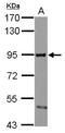 SMAD Specific E3 Ubiquitin Protein Ligase 2 antibody, NBP2-20427, Novus Biologicals, Western Blot image 