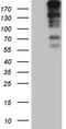 Centromere Protein J antibody, M04095, Boster Biological Technology, Western Blot image 