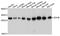 DHSB antibody, A10821, ABclonal Technology, Western Blot image 