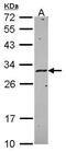 Major Histocompatibility Complex, Class II, DM Alpha antibody, GTX114939, GeneTex, Western Blot image 