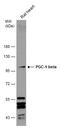 PPARG Coactivator 1 Beta antibody, GTX129682, GeneTex, Western Blot image 