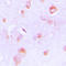 Enoyl-CoA Delta Isomerase 2 antibody, LS-C353258, Lifespan Biosciences, Immunohistochemistry frozen image 