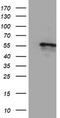 Cytochrome P450 Family 2 Subfamily A Member 6 antibody, TA503832, Origene, Western Blot image 