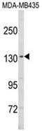 Sterol Regulatory Element Binding Transcription Factor 1 antibody, AP18209PU-N, Origene, Western Blot image 