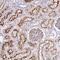 Fibroblast Growth Factor Receptor 1 antibody, HPA056402, Atlas Antibodies, Immunohistochemistry paraffin image 